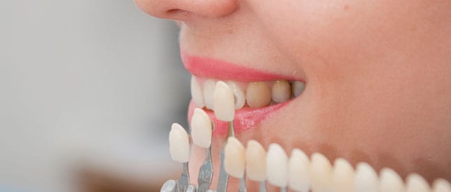 esztétikai fogászat